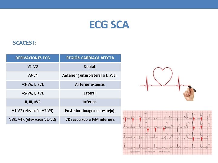 ECG SCACEST: DERIVACIONES ECG REGIÓN CARDIACA AFECTA V 1 -V 2 Septal. V 3
