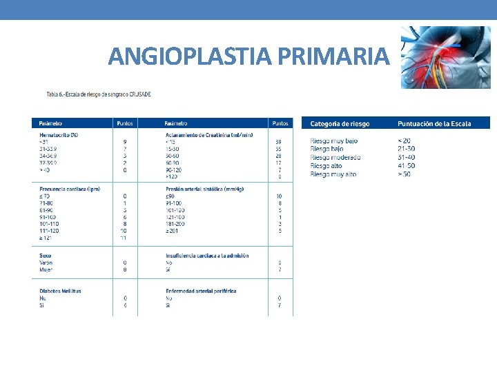 ANGIOPLASTIA PRIMARIA 