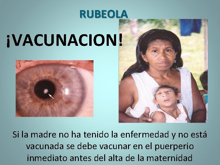 RUBEOLA ¡VACUNACION! Si la madre no ha tenido la enfermedad y no está vacunada