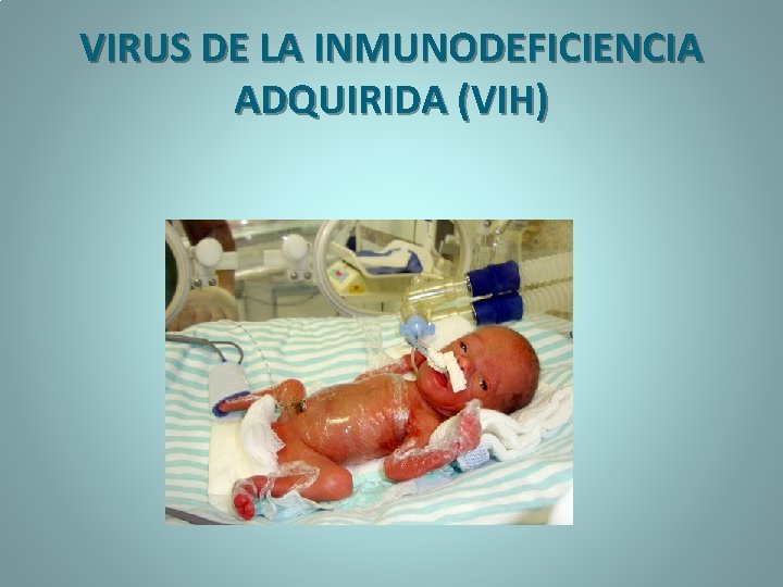 VIRUS DE LA INMUNODEFICIENCIA ADQUIRIDA (VIH) 