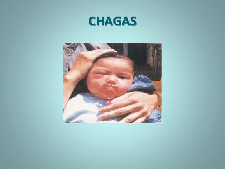 CHAGAS 