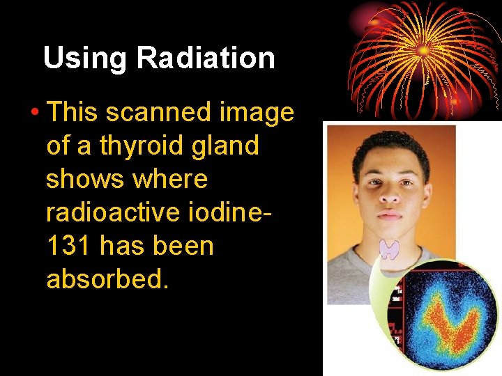 25. 4 Using Radiation • This scanned image of a thyroid gland shows where