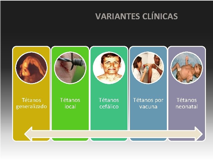 VARIANTES CLÍNICAS VARIANTES del tétanos Tétanos generalizado Tétanos local Tétanos cefálico Tétanos por vacuna