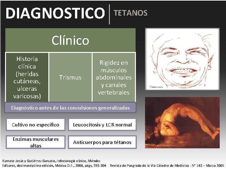 DIAGNOSTICO TETANOS Clínico Historia clínica (heridas cutáneas, ulceras varicosas) Trismus Rigidez en músculos abdominales