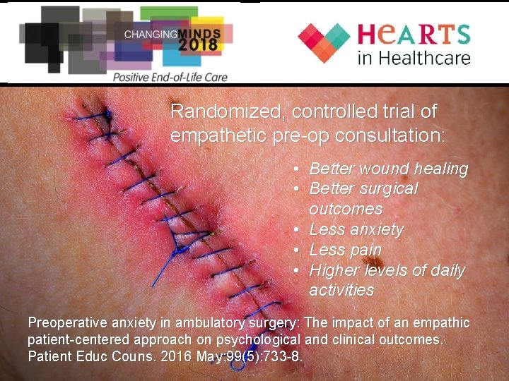 Randomized, controlled trial of empathetic pre-op consultation: • Better wound healing • Better surgical