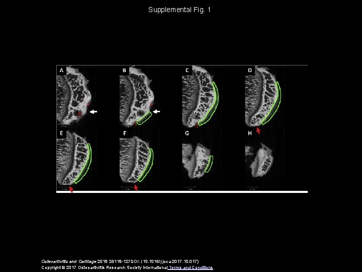 Supplemental Fig. 1 Osteoarthritis and Cartilage 2018 26118 -127 DOI: (10. 1016/j. joca. 2017.