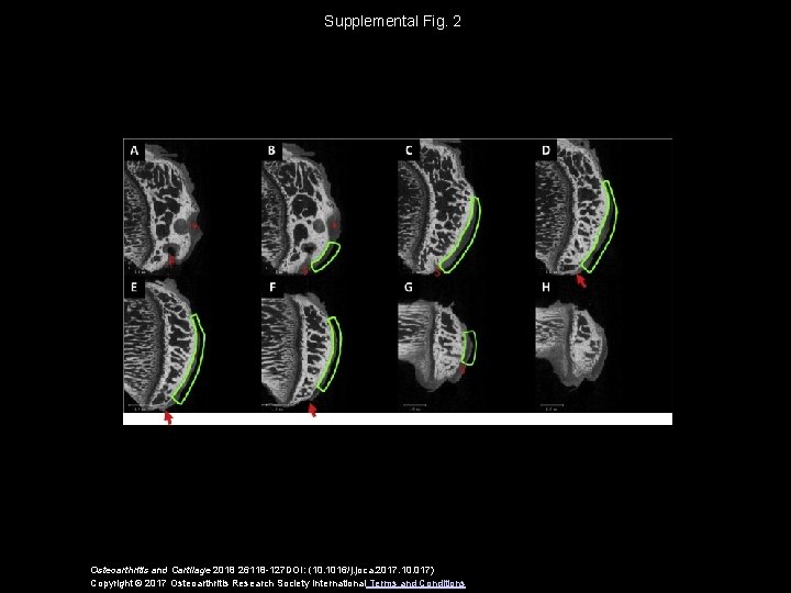 Supplemental Fig. 2 Osteoarthritis and Cartilage 2018 26118 -127 DOI: (10. 1016/j. joca. 2017.