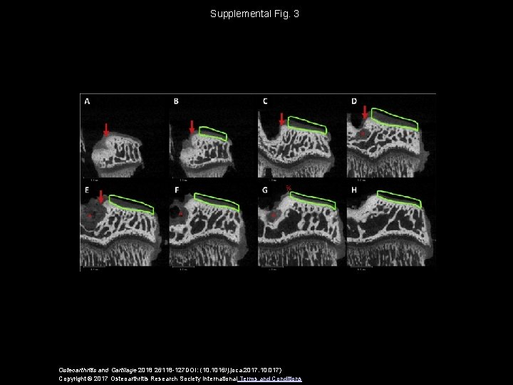 Supplemental Fig. 3 Osteoarthritis and Cartilage 2018 26118 -127 DOI: (10. 1016/j. joca. 2017.