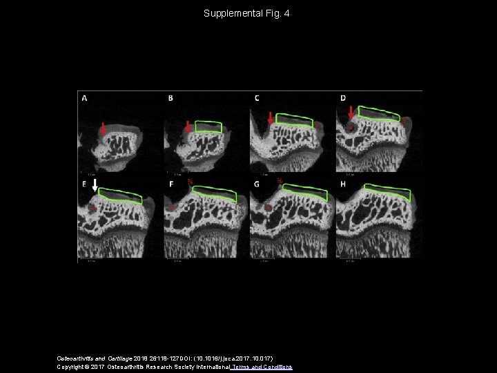 Supplemental Fig. 4 Osteoarthritis and Cartilage 2018 26118 -127 DOI: (10. 1016/j. joca. 2017.