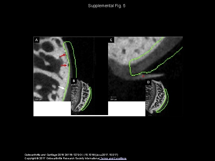 Supplemental Fig. 5 Osteoarthritis and Cartilage 2018 26118 -127 DOI: (10. 1016/j. joca. 2017.