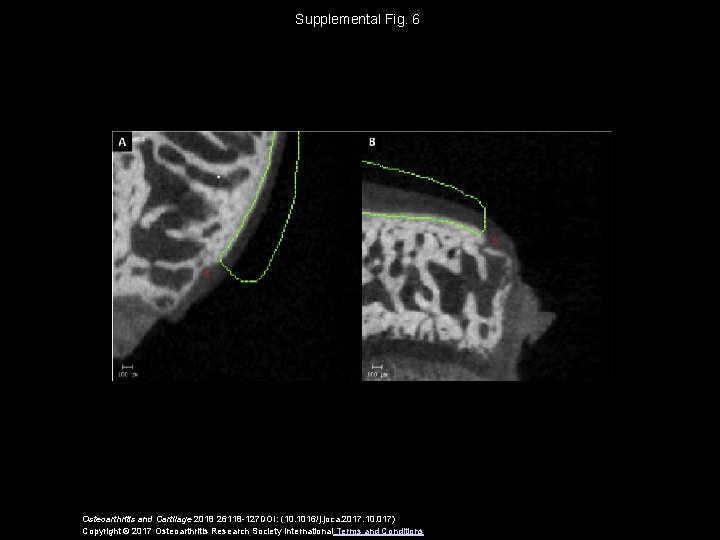 Supplemental Fig. 6 Osteoarthritis and Cartilage 2018 26118 -127 DOI: (10. 1016/j. joca. 2017.