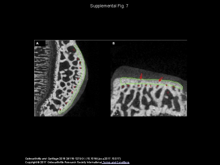 Supplemental Fig. 7 Osteoarthritis and Cartilage 2018 26118 -127 DOI: (10. 1016/j. joca. 2017.
