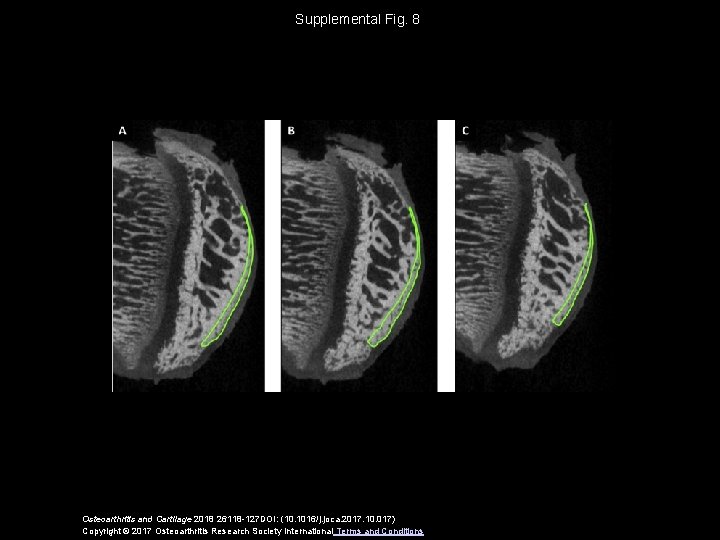 Supplemental Fig. 8 Osteoarthritis and Cartilage 2018 26118 -127 DOI: (10. 1016/j. joca. 2017.