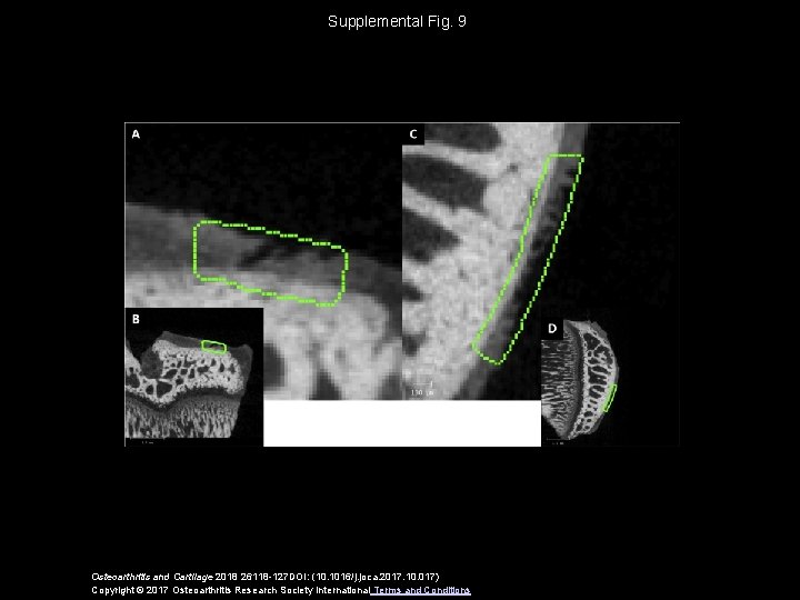 Supplemental Fig. 9 Osteoarthritis and Cartilage 2018 26118 -127 DOI: (10. 1016/j. joca. 2017.