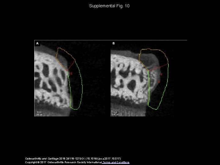 Supplemental Fig. 10 Osteoarthritis and Cartilage 2018 26118 -127 DOI: (10. 1016/j. joca. 2017.