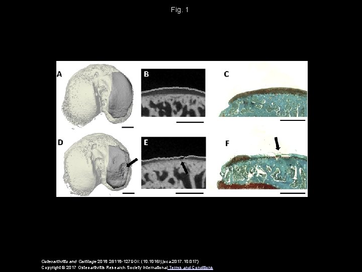 Fig. 1 Osteoarthritis and Cartilage 2018 26118 -127 DOI: (10. 1016/j. joca. 2017. 10.
