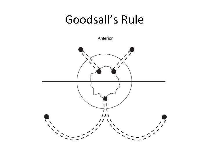 Goodsall’s Rule 