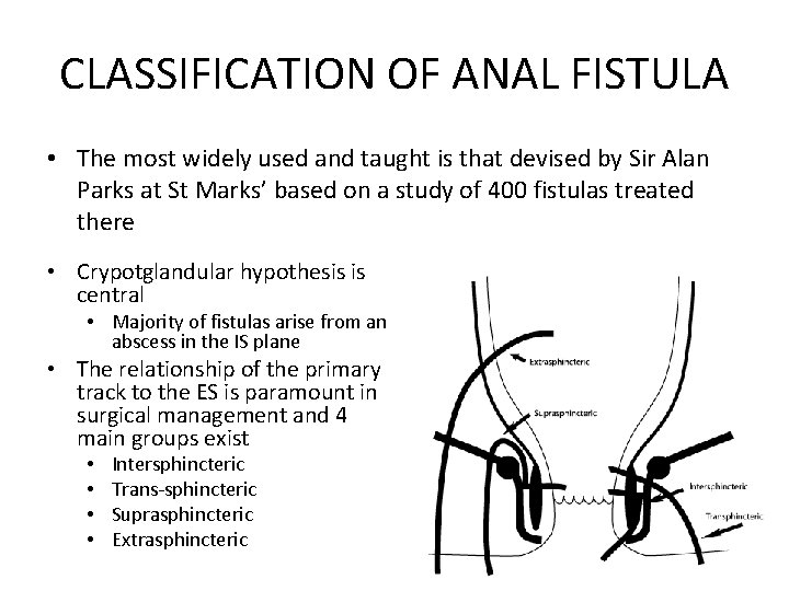 CLASSIFICATION OF ANAL FISTULA • The most widely used and taught is that devised