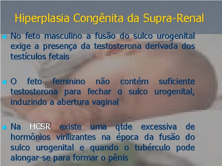 Hiperplasia Congênita da Supra-Renal n n n No feto masculino a fusão do sulco