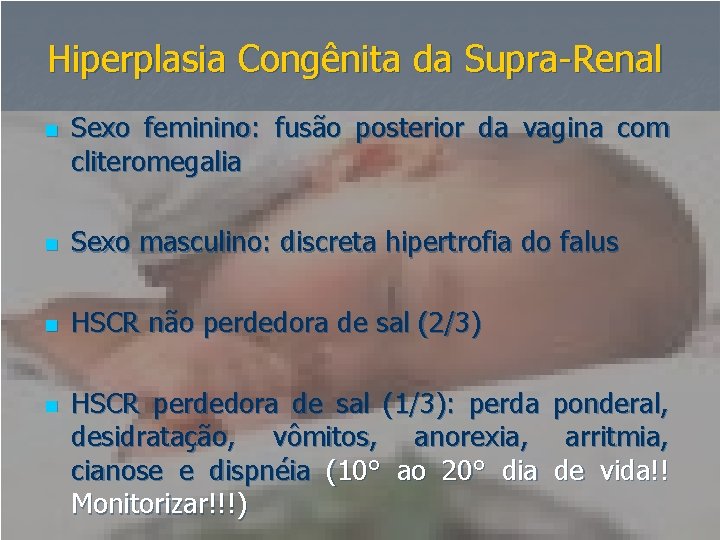 Hiperplasia Congênita da Supra-Renal n Sexo feminino: fusão posterior da vagina com cliteromegalia n