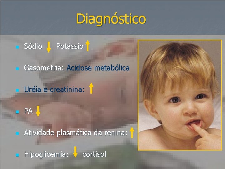 Diagnóstico n Sódio Potássio n Gasometria: Acidose metabólica n Uréia e creatinina: n PA