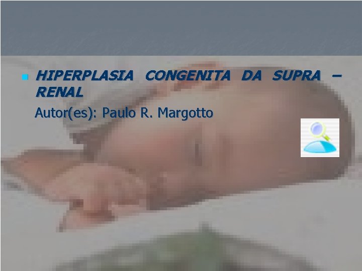 n HIPERPLASIA CONGENITA DA SUPRA – RENAL Autor(es): Paulo R. Margotto 