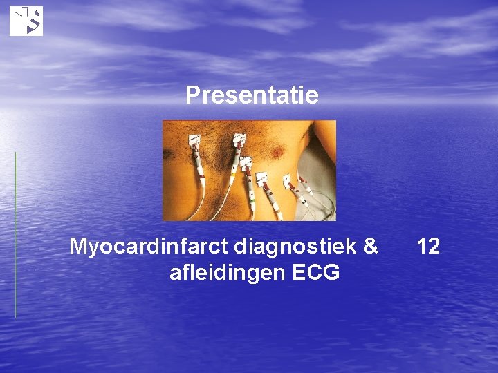 Presentatie Myocardinfarct diagnostiek & afleidingen ECG 12 