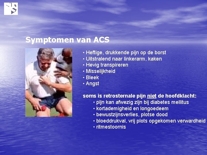 Symptomen van ACS • Heftige, drukkende pijn op de borst • Uitstralend naar linkerarm,