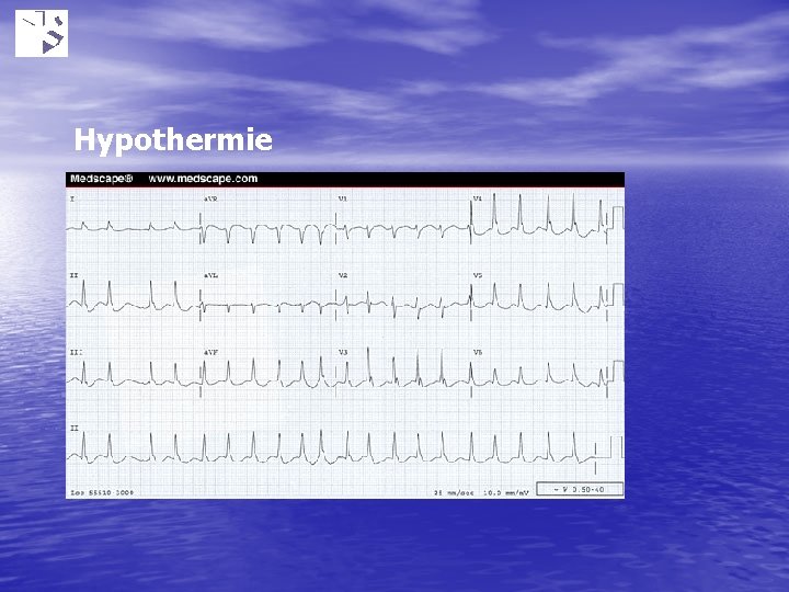 Hypothermie 