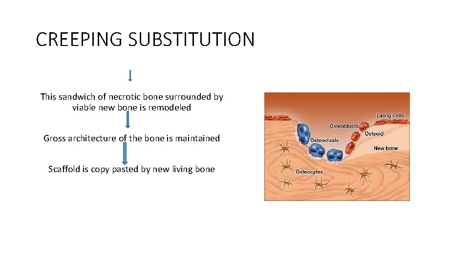 CREEPING SUBSTITUTION This sandwich of necrotic bone surrounded by viable new bone is remodeled CREEPING SUBSTITUTION This sandwich of necrotic bone surrounded by viable new bone is remodeled