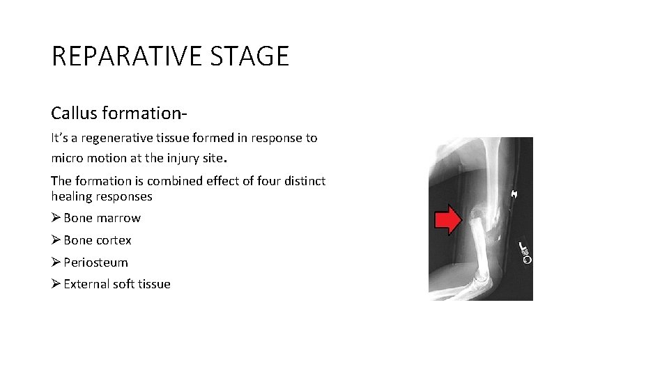 REPARATIVE STAGE Callus formation. It’s a regenerative tissue formed in response to micro motion REPARATIVE STAGE Callus formation. It’s a regenerative tissue formed in response to micro motion