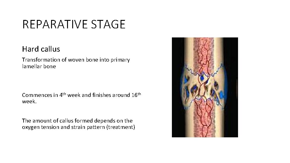 REPARATIVE STAGE Hard callus Transformation of woven bone into primary lamellar bone Commences in REPARATIVE STAGE Hard callus Transformation of woven bone into primary lamellar bone Commences in
