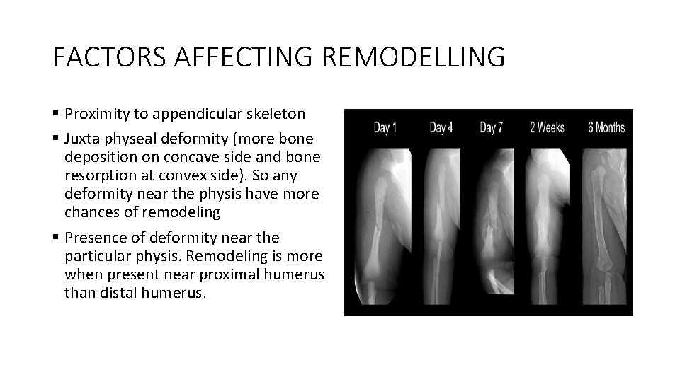 FACTORS AFFECTING REMODELLING § Proximity to appendicular skeleton § Juxta physeal deformity (more bone FACTORS AFFECTING REMODELLING § Proximity to appendicular skeleton § Juxta physeal deformity (more bone