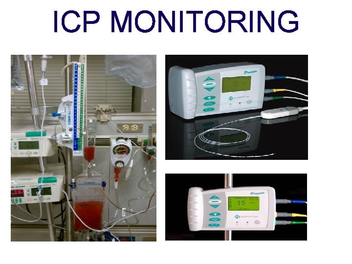 ICP MONITORING 