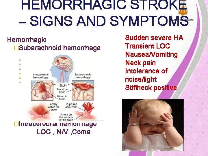 HEMORRHAGIC STROKE – SIGNS AND SYMPTOMS Hemorrhagic �Subarachnoid hemorrhage Sudden severe HA Transient LOC