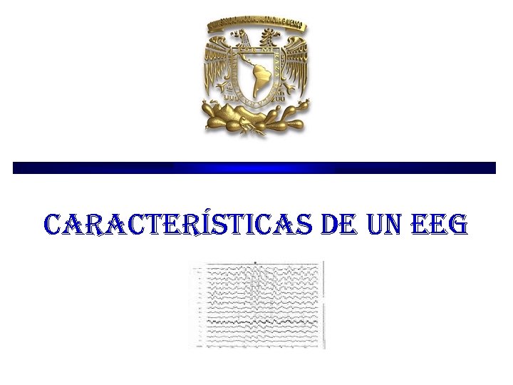 características de un eeg características de un eeg