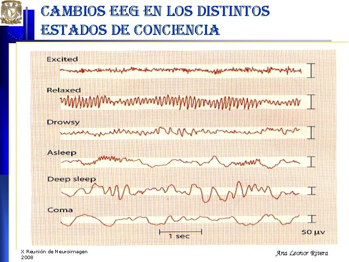 cambios eeg en los distintos estados de conciencia X Reunión de Neuroimagen 2008 Ana cambios eeg en los distintos estados de conciencia X Reunión de Neuroimagen 2008 Ana