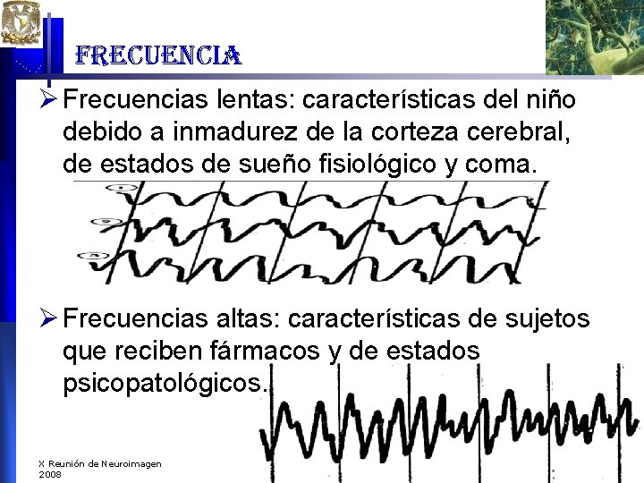 frecuencia Ø Frecuencias lentas: características del niño debido a inmadurez de la corteza cerebral, frecuencia Ø Frecuencias lentas: características del niño debido a inmadurez de la corteza cerebral,