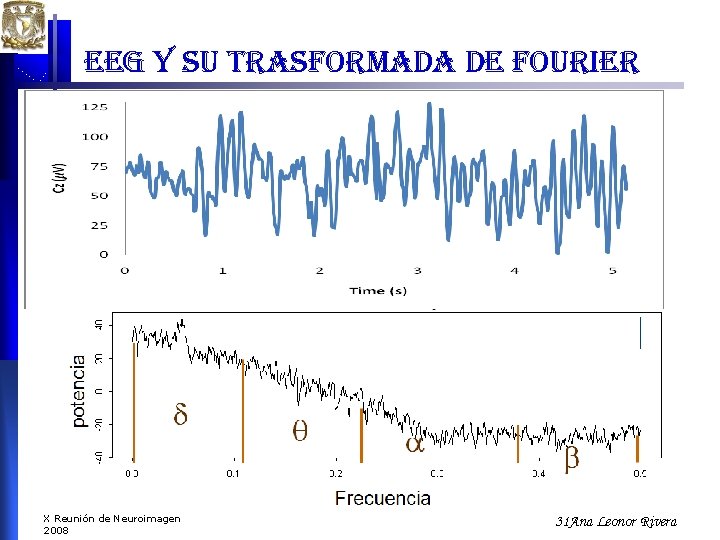 eeg y su trasformada de fourier X Reunión de Neuroimagen 2008 31 Ana Leonor eeg y su trasformada de fourier X Reunión de Neuroimagen 2008 31 Ana Leonor