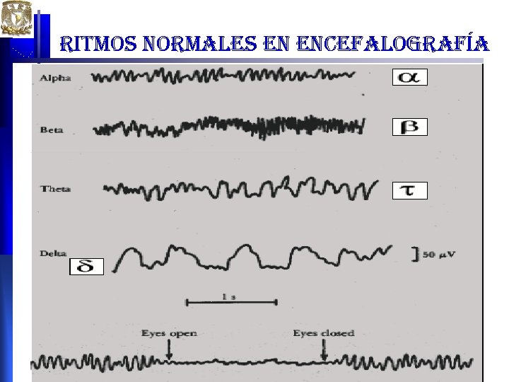 ritmos normales en encefalografía X Reunión de Neuroimagen 2008 ritmos normales en encefalografía X Reunión de Neuroimagen 2008