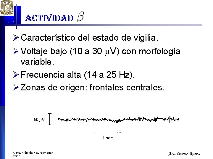 actividad Ø Característico del estado de vigilia. Ø Voltaje bajo (10 a 30 V) actividad Ø Característico del estado de vigilia. Ø Voltaje bajo (10 a 30 V)