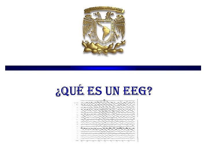 ¿qué es un eeg? ¿qué es un eeg?