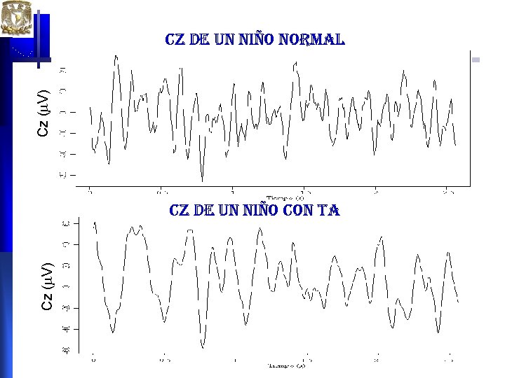 Cz ( V) cz de un niño normal Cz ( V) cz de un Cz ( V) cz de un niño normal Cz ( V) cz de un