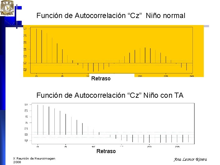 Función de Autocorrelación “Cz” Niño normal Retraso Función de Autocorrelación “Cz” Niño con TA Función de Autocorrelación “Cz” Niño normal Retraso Función de Autocorrelación “Cz” Niño con TA