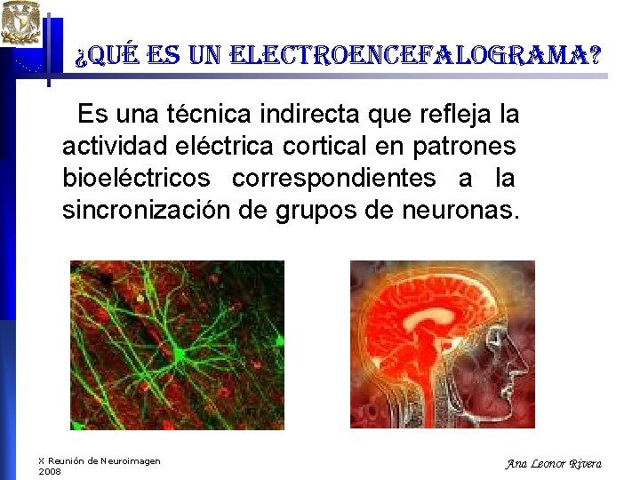 ¿qué es un electroencefalograma? Es una técnica indirecta que refleja la actividad eléctrica cortical ¿qué es un electroencefalograma? Es una técnica indirecta que refleja la actividad eléctrica cortical