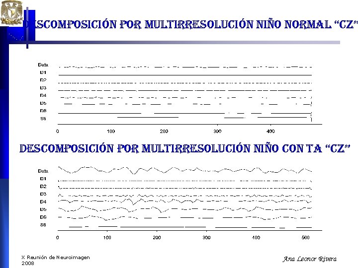 descomposición por multirresolución niño normal “cz” descomposición por multirresolución niño con ta “cz” X descomposición por multirresolución niño normal “cz” descomposición por multirresolución niño con ta “cz” X