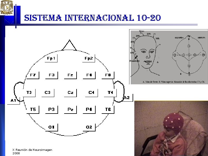 sistema internacional 10 -20 X Reunión de Neuroimagen 2008 sistema internacional 10 -20 X Reunión de Neuroimagen 2008