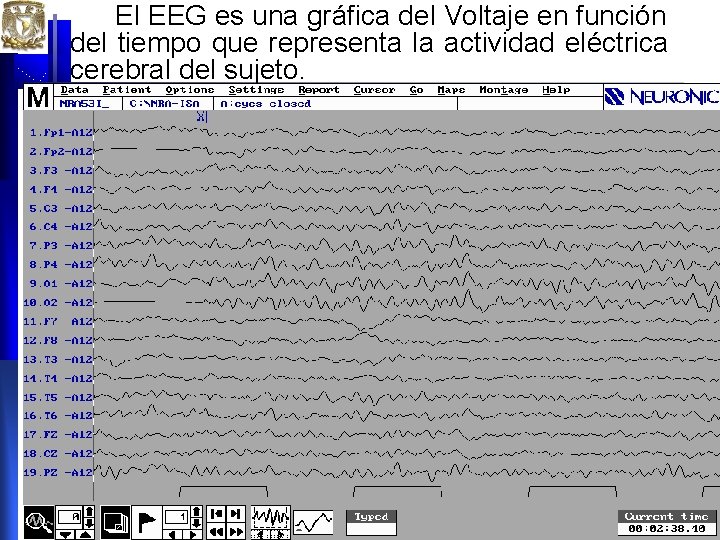 El EEG es una gráfica del Voltaje en función del tiempo que representa la El EEG es una gráfica del Voltaje en función del tiempo que representa la