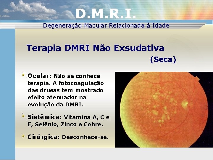 D. M. R. I. Degeneração Macular Relacionada à Idade Terapia DMRI Não Exsudativa (Seca)