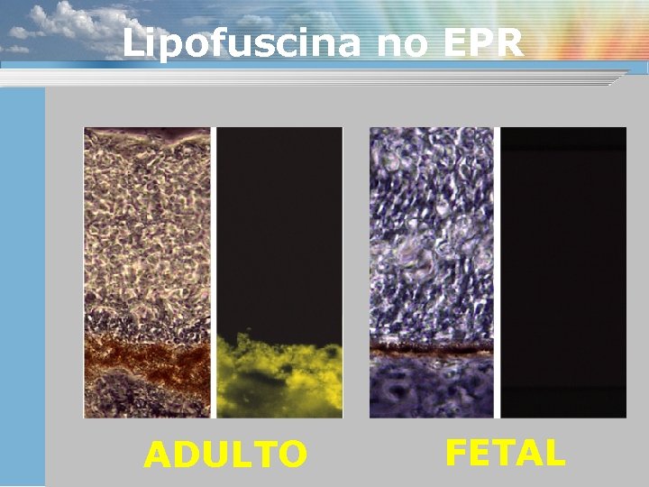 Lipofuscina no EPR ADULTO FETAL 